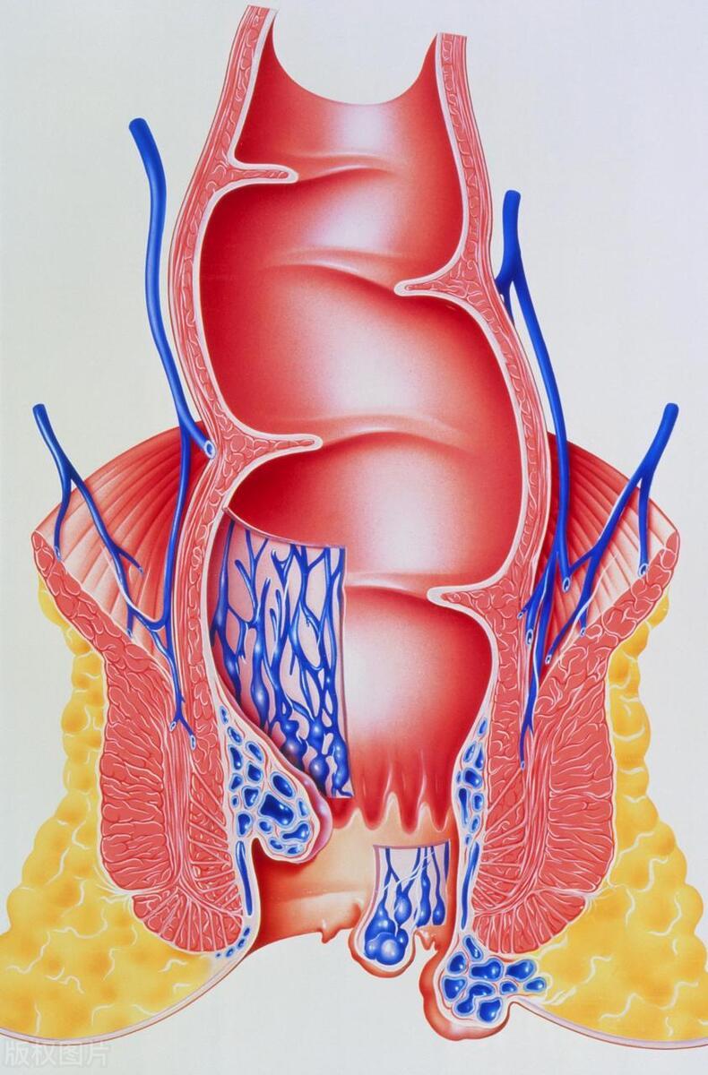 痔疮治疗新技术，观点阐述、立场分析与最新治疗进展